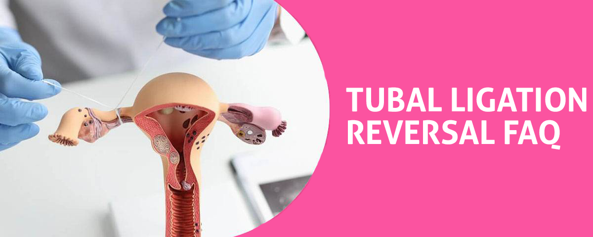How Can I Tell What Type of Tubal Ligation I Had?